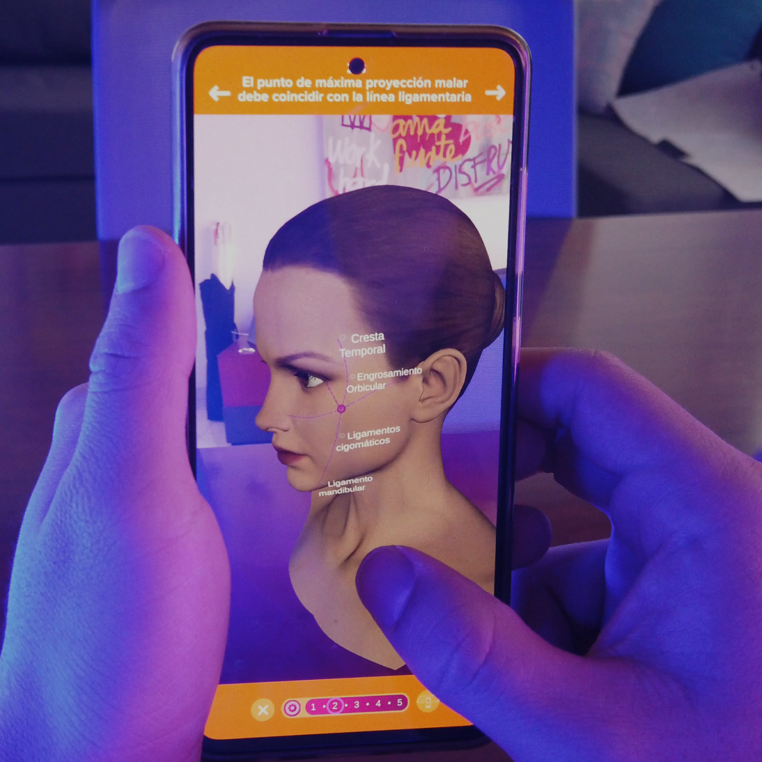 Interfaz de simulación digital mostrando zonas de aplicación de Belotero en un modelo 3D.